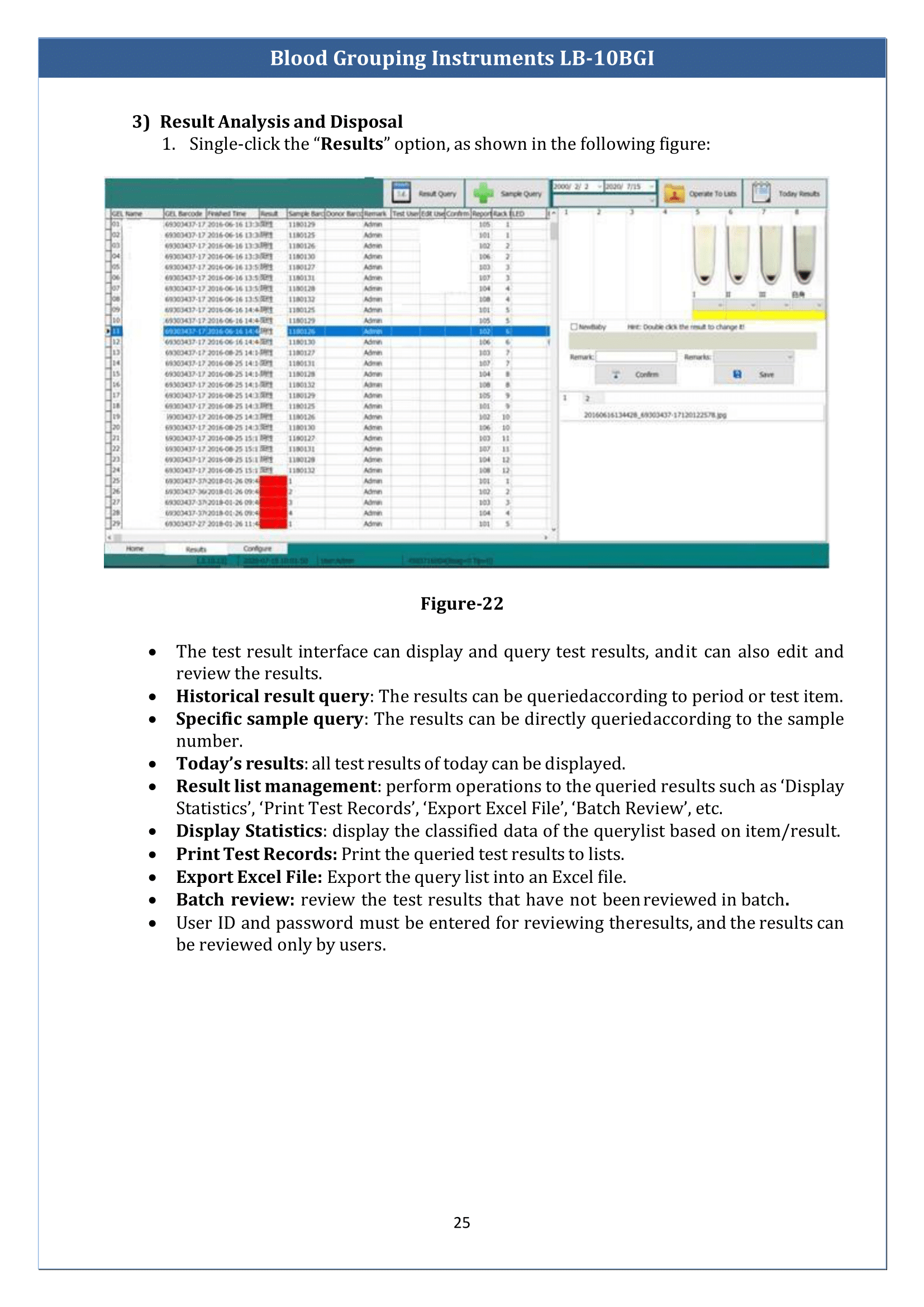 Blood-Grouping-Instrument-LB-10BGI-26.png