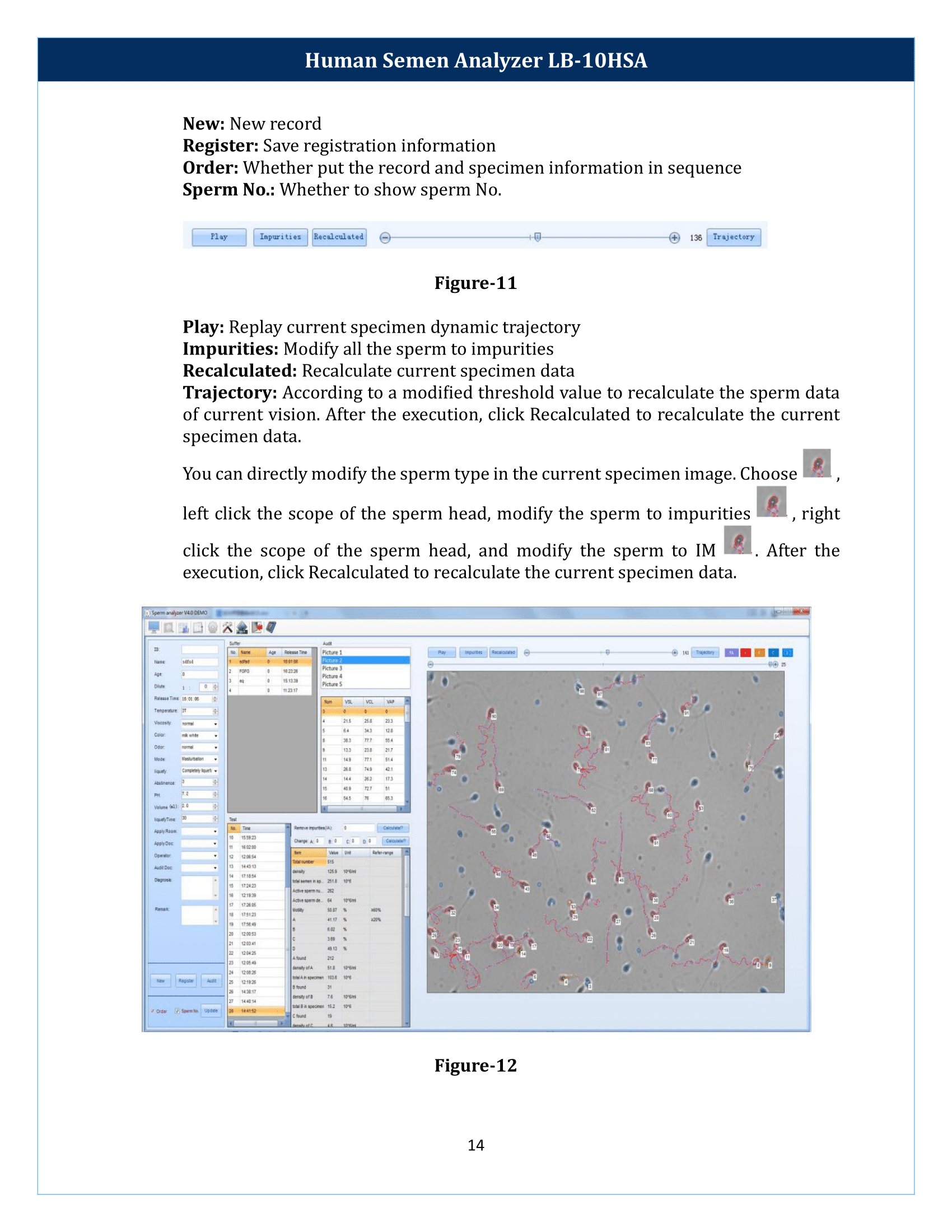 Human-Semen-Analyzer-LB-10HSA-15.png