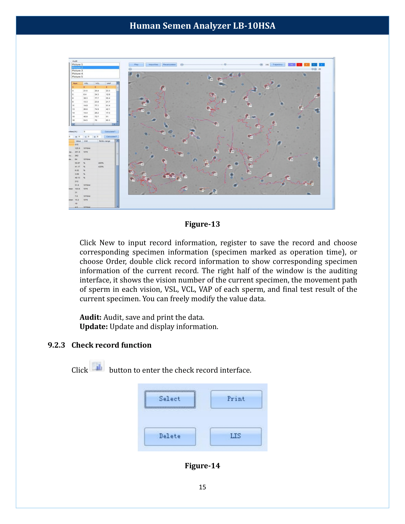 Human-Semen-Analyzer-LB-10HSA-16.png