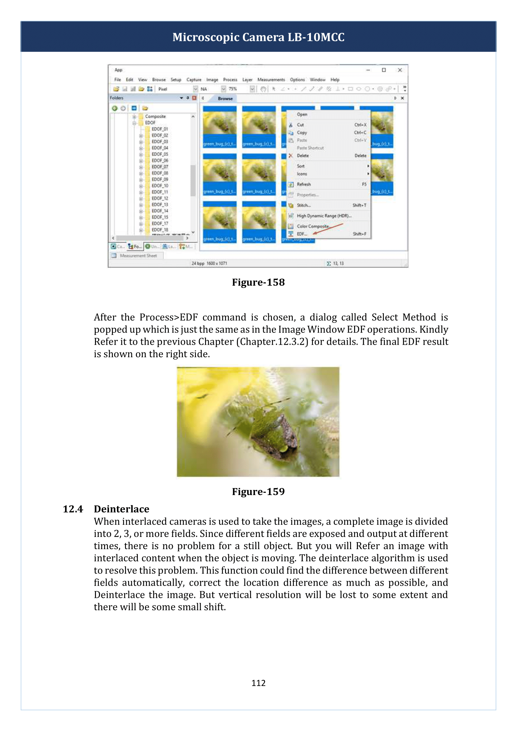 microscopic-camera-lb-10mcc-113.png